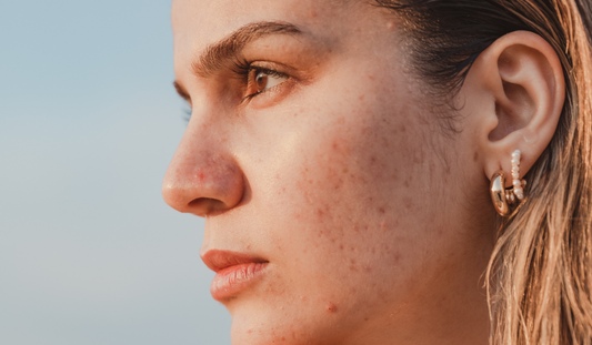 A close up photo of a lady's face 